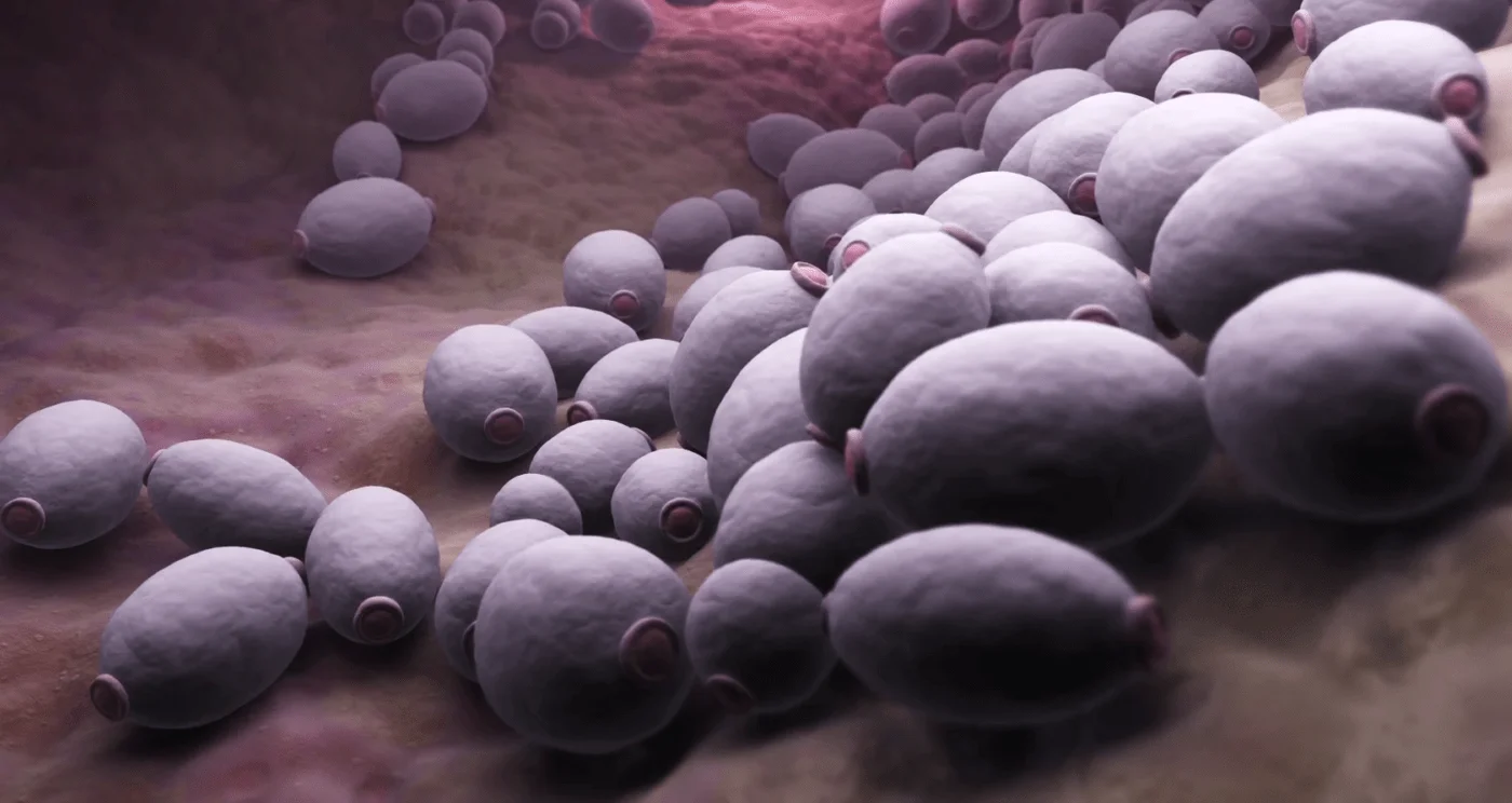Candidiasis e hipotiroidismo