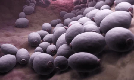 Candidiasis e hipotiroidismo
